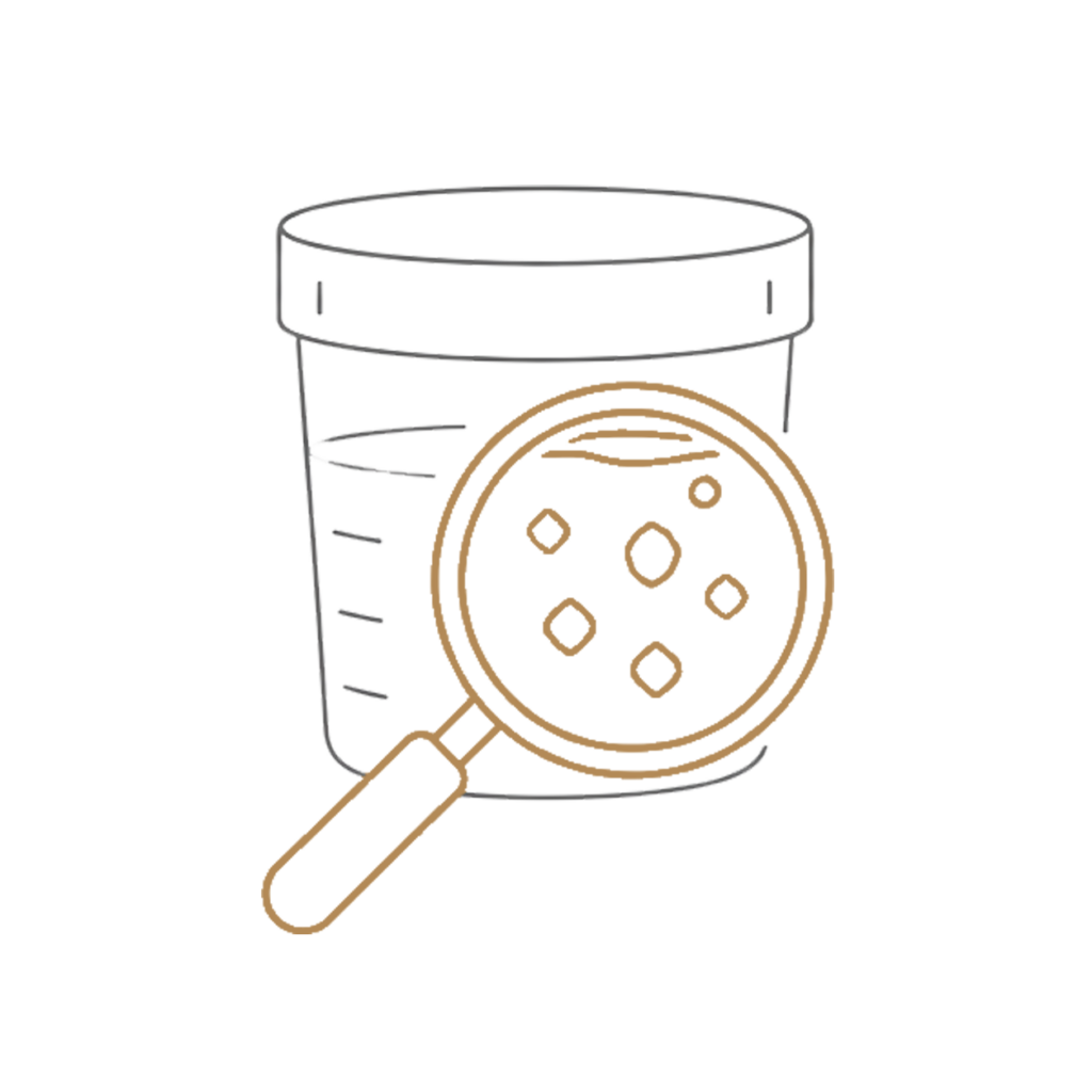 Urinanalse grafik