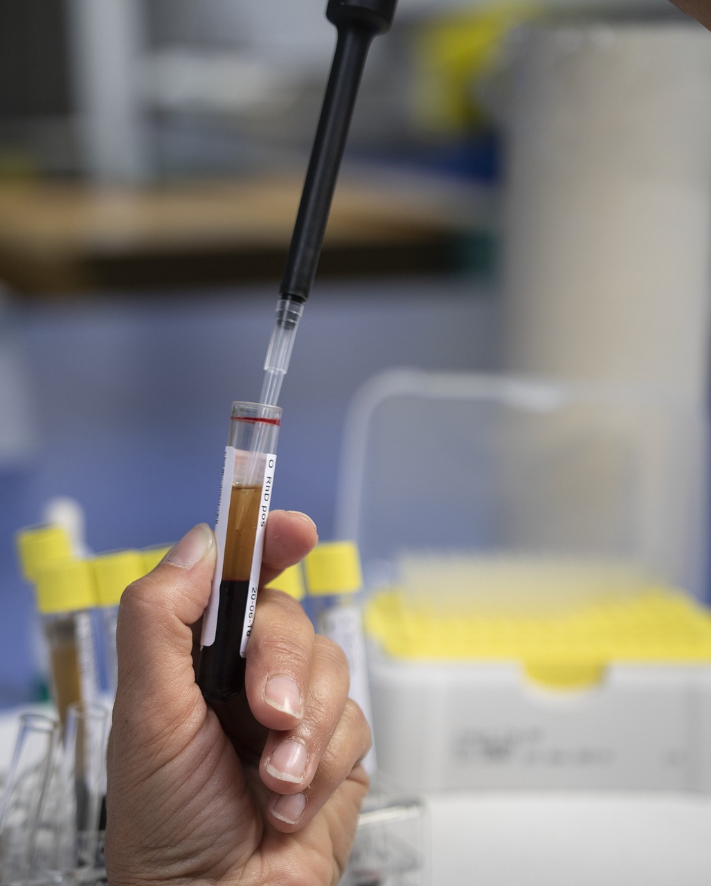 analysis, laboratory, test, medical, tests, health, diagnostician, diagnostics, biochemistry, lab, sample, hand, fluid, microbiology, scientific, glass, tube
