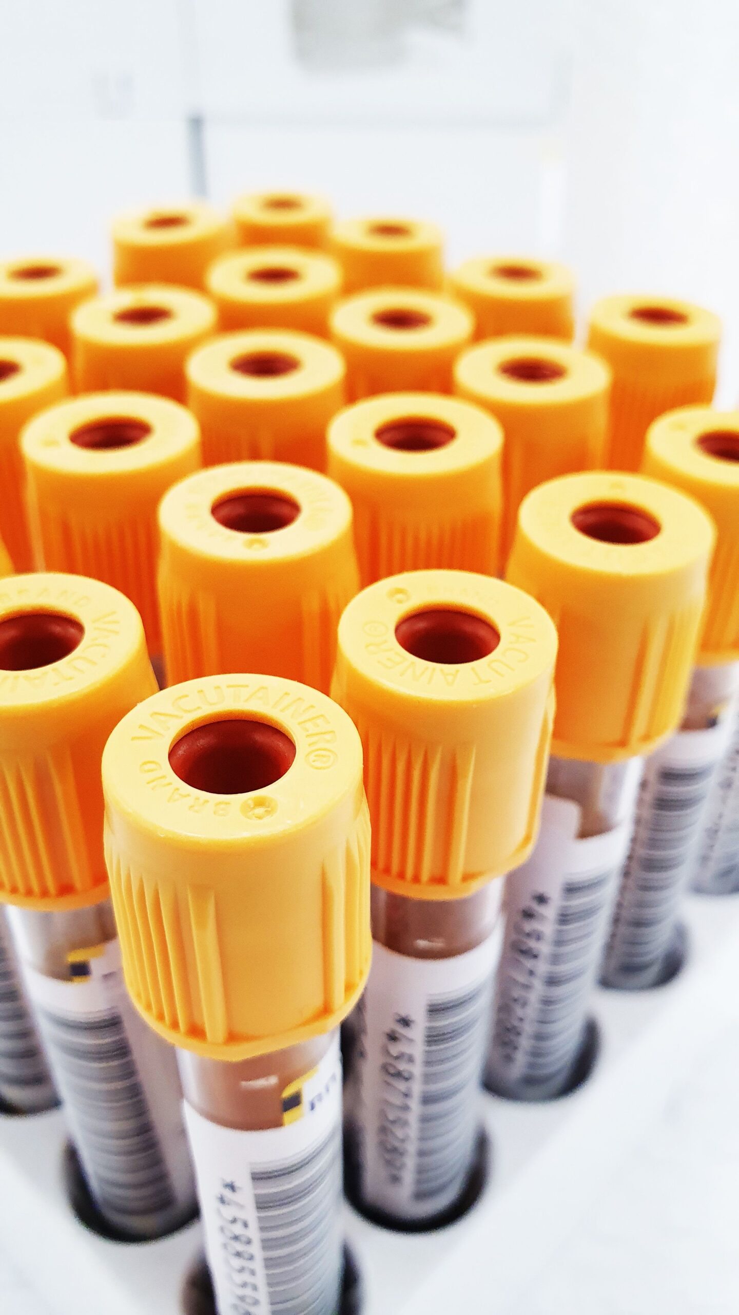 Detailed close-up of several test tubes with yellow caps used in medical testing in a laboratory.